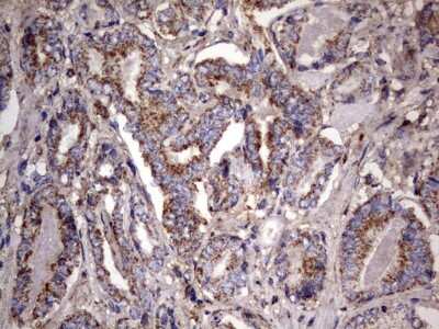 Immunohistochemistry: NRBF2 Antibody (OTI1A2) [NBP2-46258]