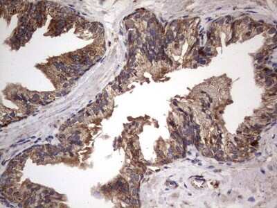 Immunohistochemistry: NRBF2 Antibody (OTI1A2) [NBP2-46258]