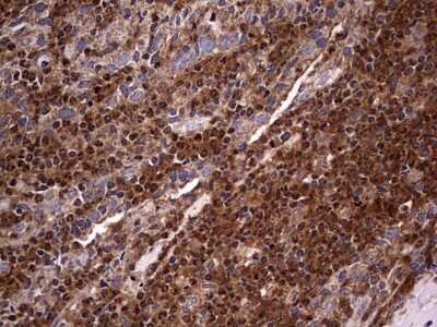 Immunohistochemistry: NRBF2 Antibody (OTI1A2) [NBP2-46258]