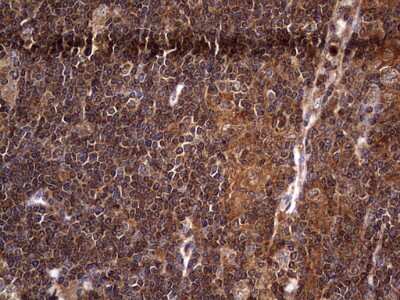 Immunohistochemistry: NRBF2 Antibody (OTI1A2) [NBP2-46258]