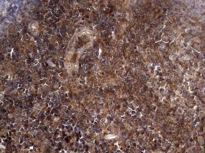 Immunohistochemistry: NRBF2 Antibody (OTI1A2) [NBP2-46258]