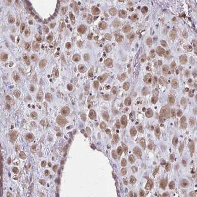 Immunohistochemistry: NRBF2 Antibody [NBP2-33893]