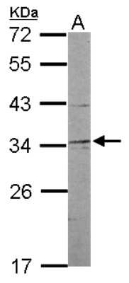 Western Blot: NRBF2 Antibody [NBP2-19583]