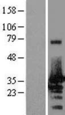 Western Blot: NRBF2 Overexpression Lysate [NBL1-13786]