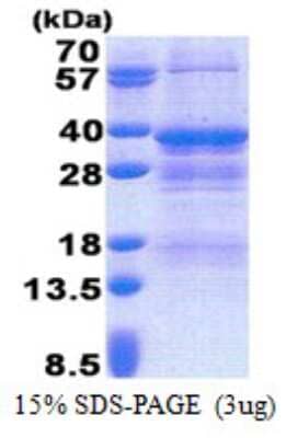 SDS-PAGE: Recombinant Human NRBF2 His Protein [NBP2-23297]