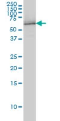 Western Blot: NRBP1 Antibody (4D2) [H00029959-M01]