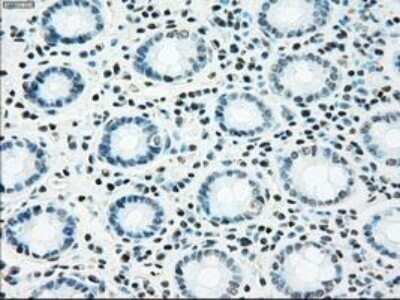 Immunohistochemistry: NRBP1 Antibody (OTI5C3) - Azide and BSA Free [NBP2-73056]