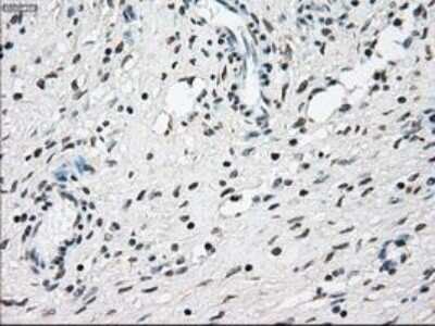 Immunohistochemistry: NRBP1 Antibody (OTI5C3) - Azide and BSA Free [NBP2-73056]