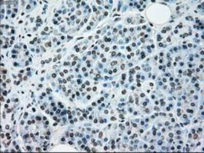 Immunohistochemistry: NRBP1 Antibody (OTI5C3) - Azide and BSA Free [NBP2-73056]