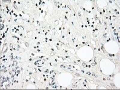 Immunohistochemistry: NRBP1 Antibody (OTI5C3) - Azide and BSA Free [NBP2-73056]