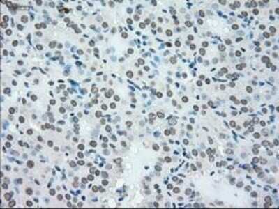 Immunohistochemistry: NRBP1 Antibody (OTI5C3) - Azide and BSA Free [NBP2-73056]