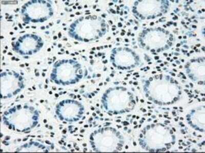 Immunohistochemistry-Paraffin: NRBP1 Antibody (OTI5C3) [NBP1-47883]