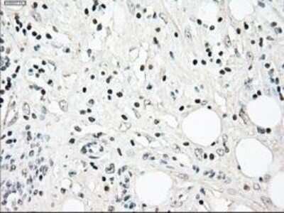 Immunohistochemistry-Paraffin: NRBP1 Antibody (OTI5C3) [NBP1-47883]