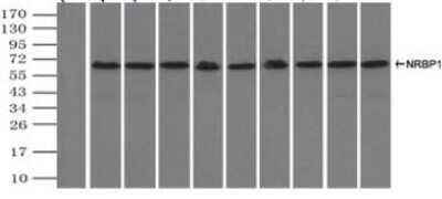 Immunoprecipitation: NRBP1 Antibody (OTI5C3) [NBP1-47883]