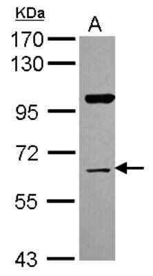 Western Blot: NRBP1 Antibody [NBP2-19584]