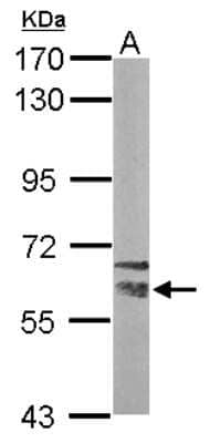 Western Blot: NRBP1 Antibody [NBP2-19584]