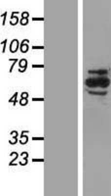 Western Blot: NRBP1 Overexpression Lysate [NBL1-13787]