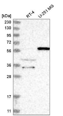 Western Blot: NRBP2 Antibody [NBP2-58227]