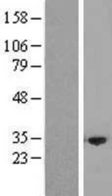 Western Blot: NRBP2 Overexpression Lysate [NBP2-04953]