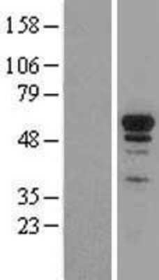 Western Blot: Nrf1 Overexpression Lysate [NBL1-13789]