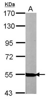 Western Blot: Neuregulin-1/NRG1 Antibody [NBP2-19587]