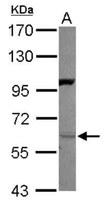 Western Blot: Neuregulin-1/NRG1 Antibody [NBP2-19588]