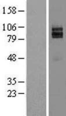 Western Blot: Neuregulin-1/NRG1 Overexpression Lysate [NBL1-13790]