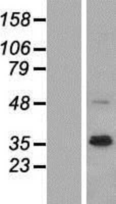 Western Blot: Neuregulin-1/NRG1 Overexpression Lysate [NBP2-09853]