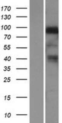 Western Blot: Neuregulin-1/NRG1 Overexpression Lysate [NBP2-09855]