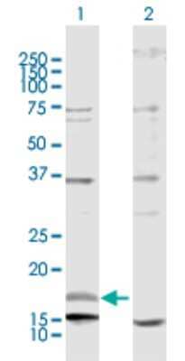 Western Blot: NRG4 Antibody [H00145957-D01P]