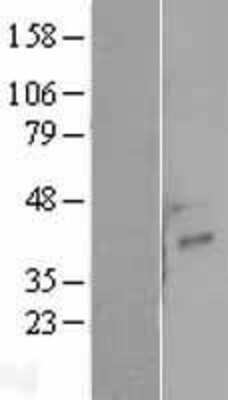 Western Blot: NRG4 Overexpression Lysate [NBP2-04418]