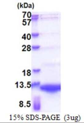 SDS-PAGE: Recombinant Human NRG4 His Protein [NBP2-23278]