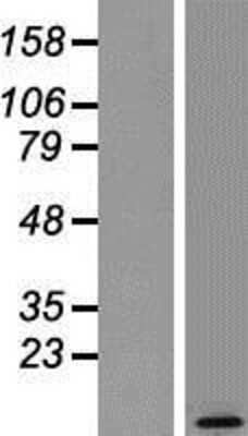 Western Blot: Neurogranin Overexpression Lysate [NBP2-07656]