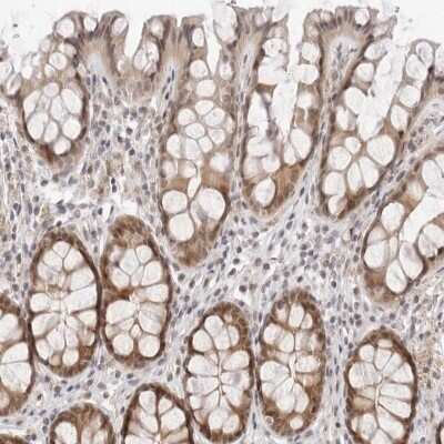 Immunohistochemistry-Paraffin: NRIF3 Antibody [NBP1-85687]