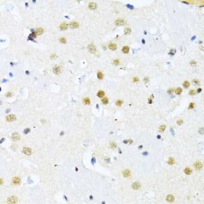 Immunohistochemistry-Paraffin: NRIF3 Antibody - Azide and BSA Free [NBP3-03238]