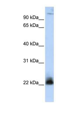 Western Blot: NRIF3 Antibody [NBP1-59187]