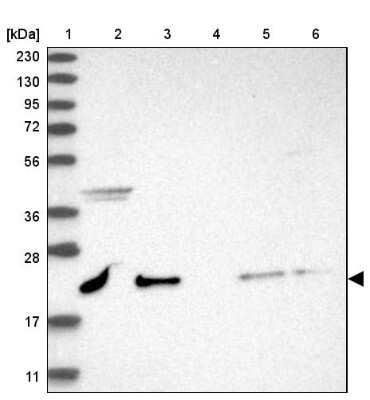 Western Blot: NRIF3 Antibody [NBP1-85687]