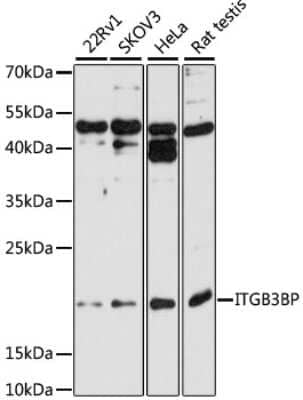 Western Blot: NRIF3 AntibodyAzide and BSA Free [NBP2-94407]