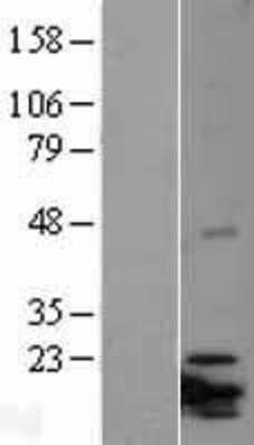 Western Blot: NRIF3 Overexpression Lysate [NBL1-12074]