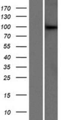 Western Blot: NRIP Overexpression Lysate [NBP2-06794]