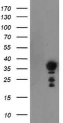 Western Blot: NRIP3 Antibody (OTI1A9) [NBP2-45876]