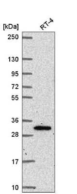 Western Blot: NRIP3 Antibody [NBP2-58112]