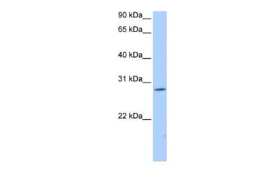 Western Blot: NRIP3 Antibody [NBP3-09281]