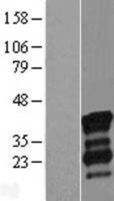 Western Blot: NRIP3 Overexpression Lysate [NBL1-13794]