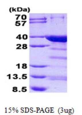 SDS-PAGE: Recombinant Human NRIP3 His Protein [NBP2-23298]