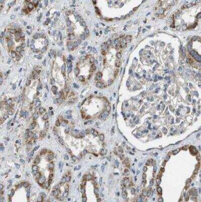 Immunohistochemistry-Paraffin: NRK Antibody [NBP1-84121]