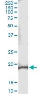 Immunoprecipitation: NRK1 Antibody (2A10) [H00054981-M01]