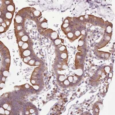 Immunohistochemistry-Paraffin: NRK1 Antibody [NBP2-14426]