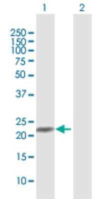 Western Blot: NRK1 Antibody [H00054981-D01P]