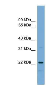 Western Blot: NRK1 Antibody [NBP1-79662]